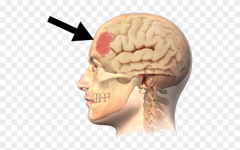 Oversleeping Causes Blunt Brain - Head Skull Brain #542341