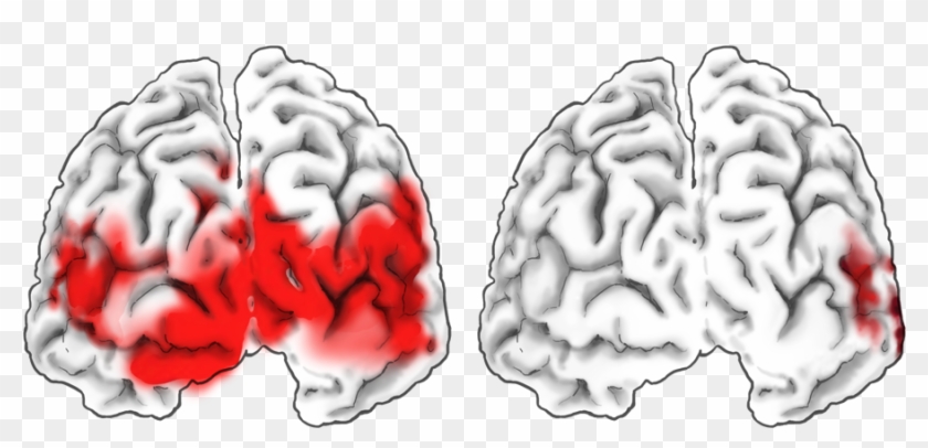 Foundation Text Neuroimaging Visualizing Brain - Illustration #542513