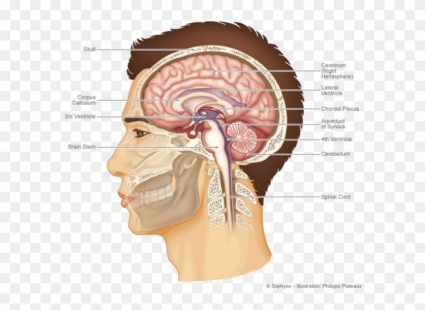 Hydrocephalus Treatment - Cerebrospinal Fluid #542996