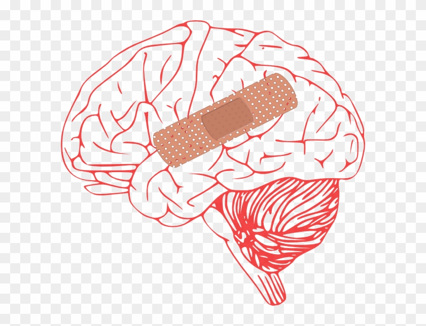 Brain Injury Clip Art At Clker - Stroke Clipart #543835