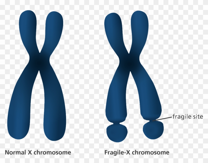 The Center For Disease Control Describe Autism Spectrum - Fragile X Mental Retardation 1 #544057