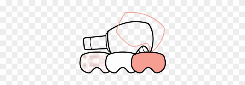 Quick-change Lens System - Quick-change Lens System #544390