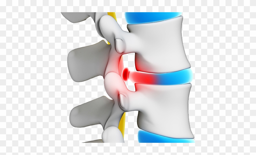 Patients May Come To Austin Surgical Institute For - Bel Fıtığı #553475