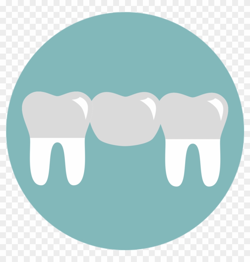 A Bridge Is One Method To Replace Missing Teeth, And - Angel Tube Station #563288