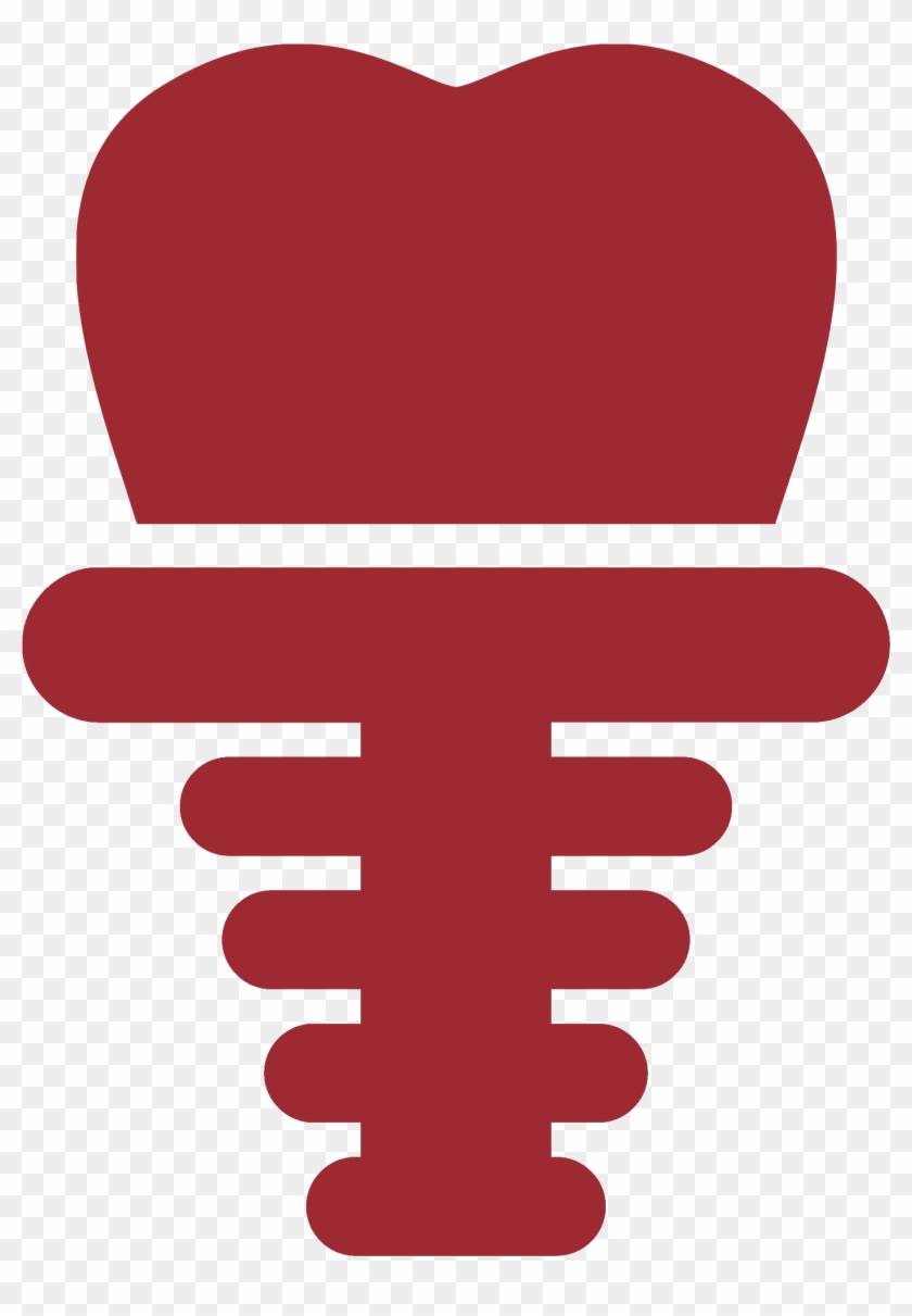 Dental Implants - Dental Implant #563399