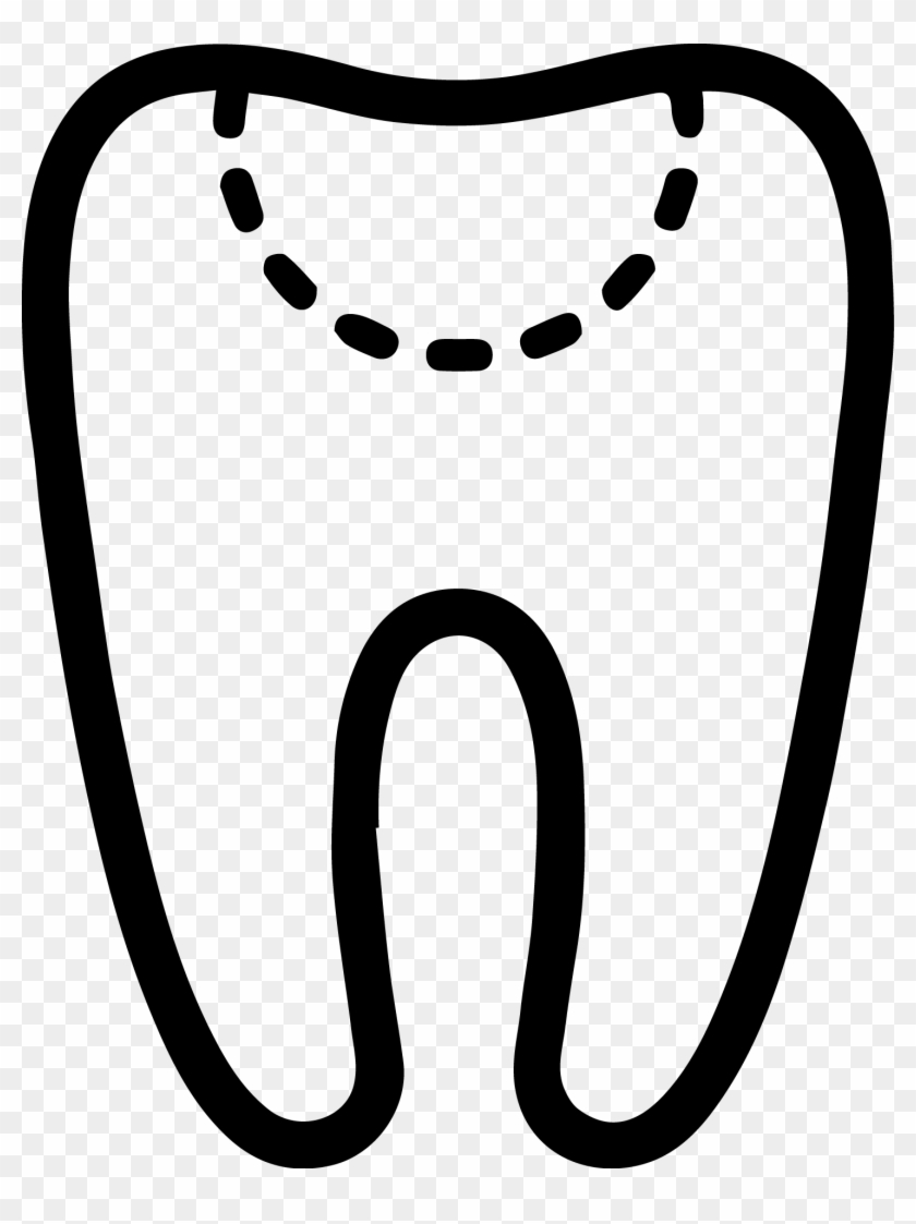 Drawing Of A Tooth - Tooth Decay #563409