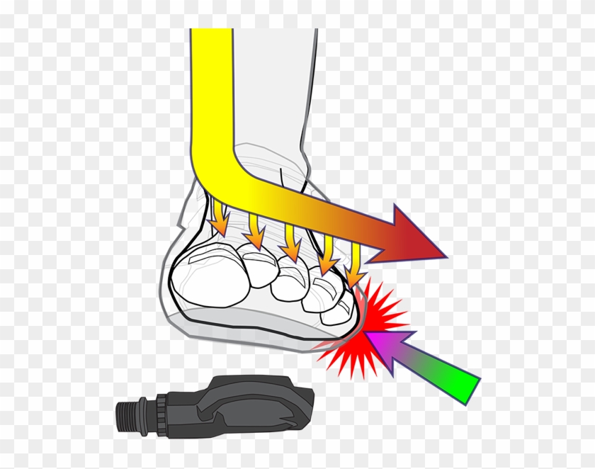 Cleat Wedges® Enable The Cycling Shoe To Connect With - Cycling Foot Pain Outside #585449