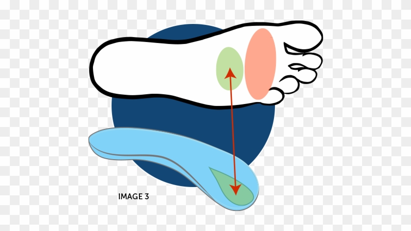 Ball Of Foot Pain Illustration Step - Podalgia #585506