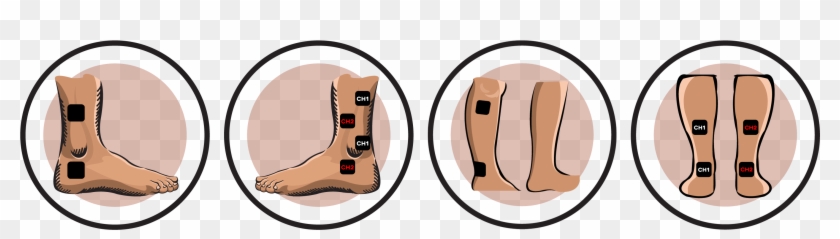 Ankle Tens Unit Placement #585573