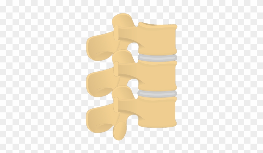 Lumbar Vertebrae - Articulated View - Lumbar Vertebrae #593935