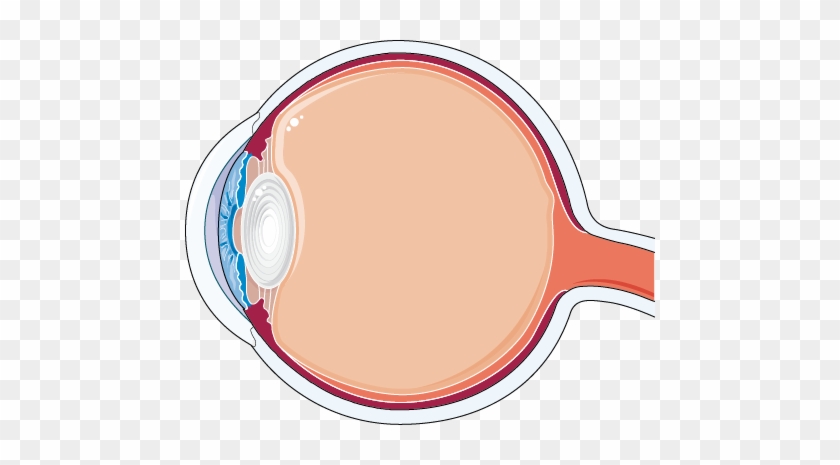 Cataract - Cataract Surgery #605562