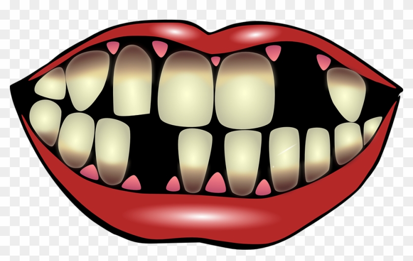 Various Types Of Dental Services - Wisdom Tooth #622496