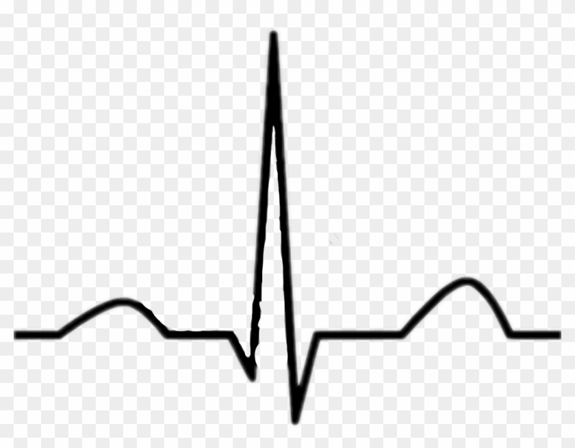 Normal Ekg #624938