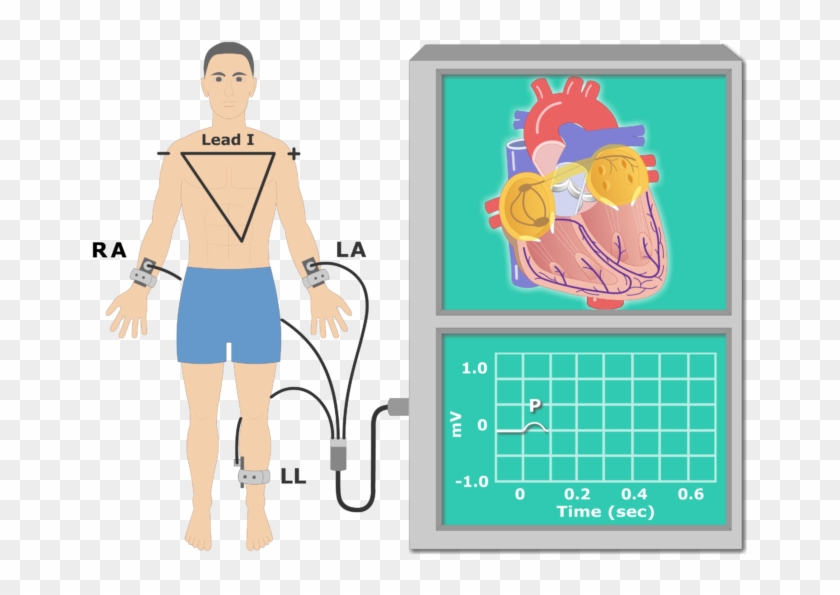 The P Wave Ekg Recording Animation Slide - Ekg Animation #624950