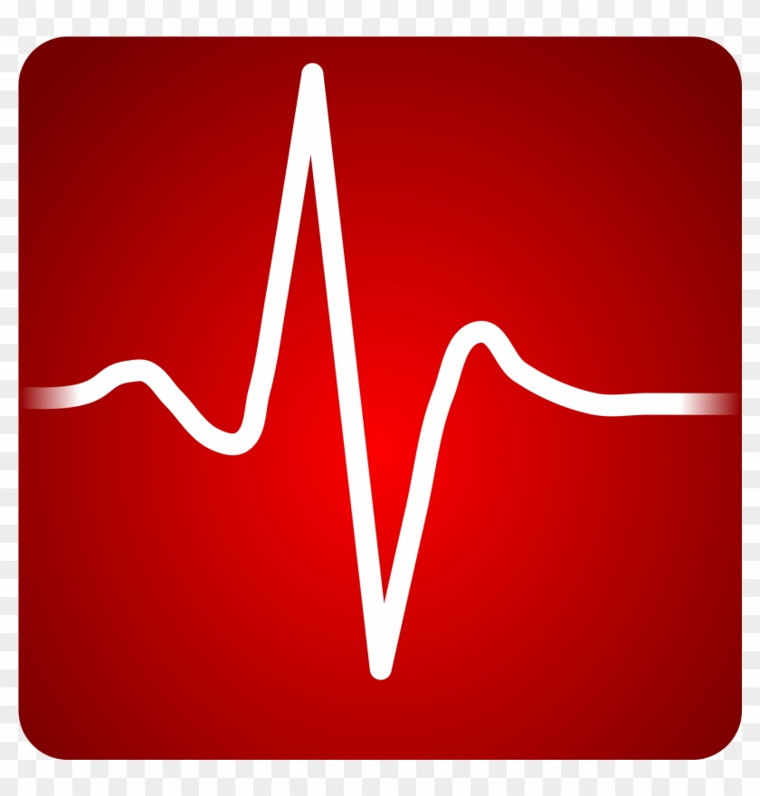 Open - Rapid Heart Beat #625005