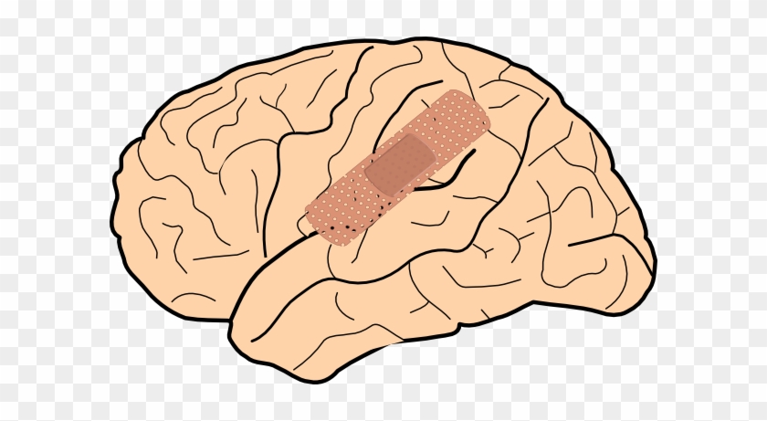 Brain Injury Clipart Clip Art At Clker Com Vector Online - Brain Damage Clipart #115761