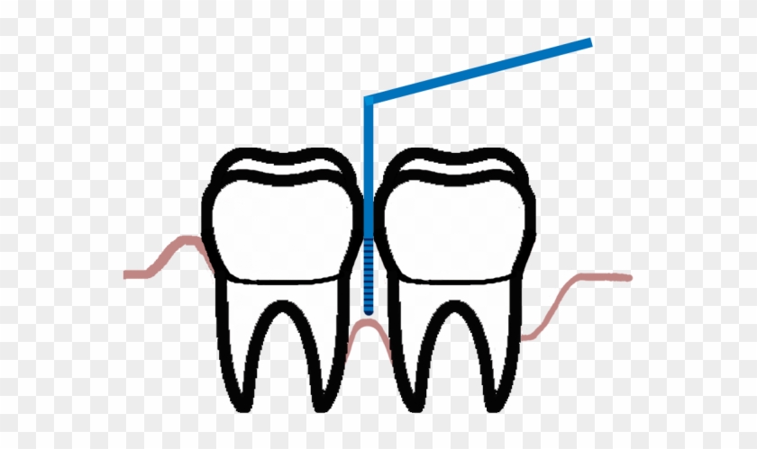 The Disease Of The Supporting Tissues Of Teeth Generates - Periodontology #637308