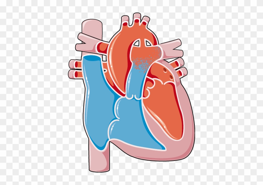 Download The Image - Ventricular Septal Defect #640703