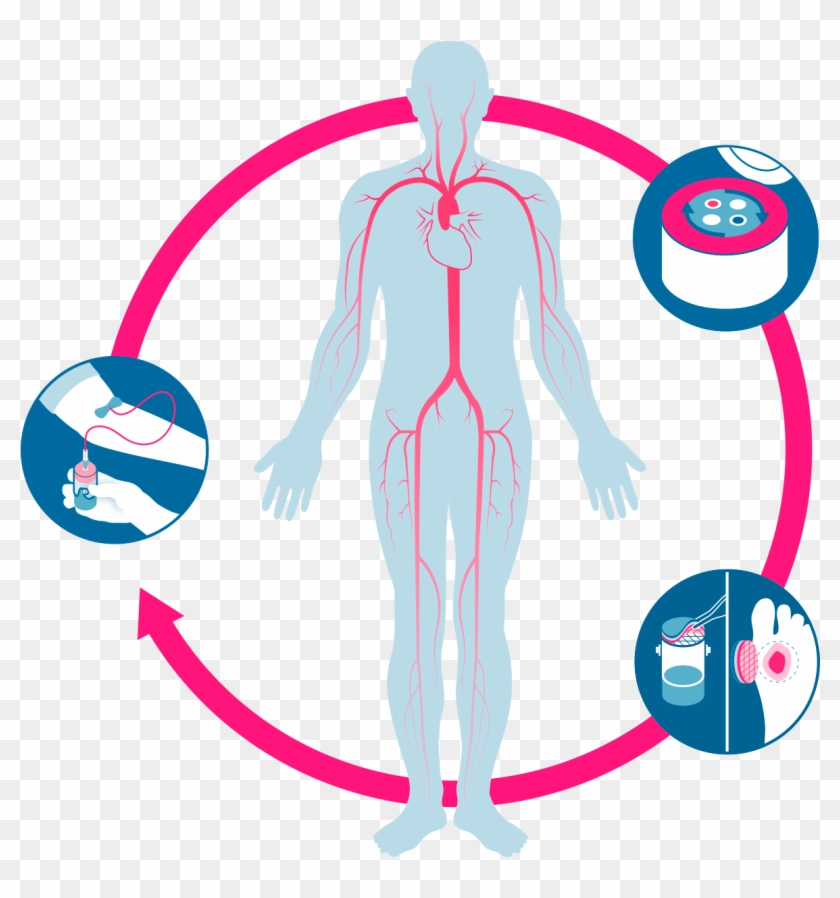 Treatment Evidence Technology - Wound Healing #646337