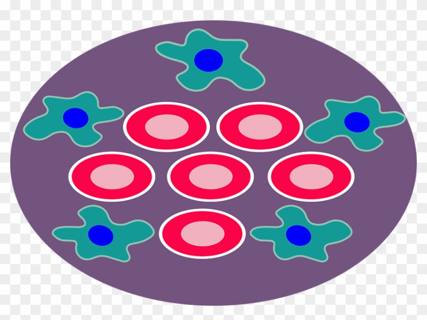 Boron-10 Accumulates In The Subject's Tumor Cells Continue - Circle #647108