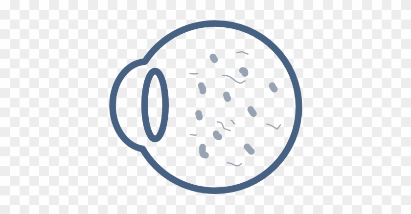 Flashes And Floaters - Circle #653854