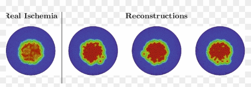 Reconstruction Of A Ischemic Area Considering Different - Circle #664948