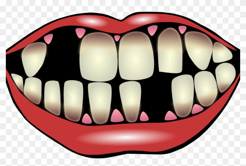 9 Factors For Losing Your Teeth - Bright Smile Clipart #669647