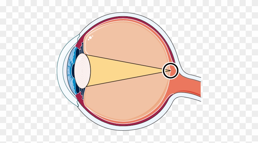 Normal Eye - Structure De L Oeil #671046