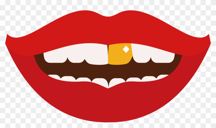 Tooth Gold Teeth Clip Art - Gold Teeth Clip #674076