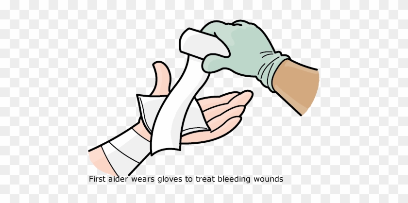 External Bleeding - First Aid For Bleeding #675096
