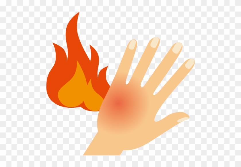 Burn Gout Skin Cartoon Hand - Quemaduras Png #676660