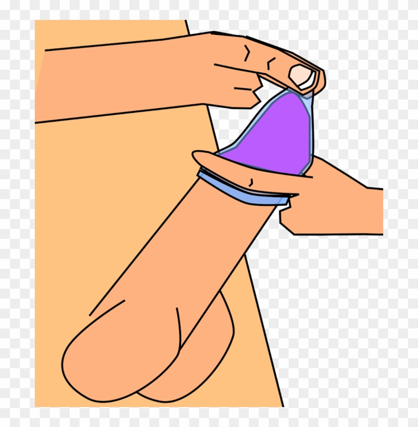 Kondom Abrollen - Scalable Vector Graphics #679055