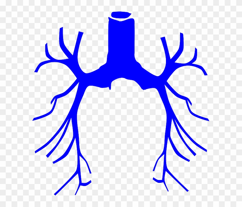 What Is Bronchiectasis - Lungs Clip Art #727652