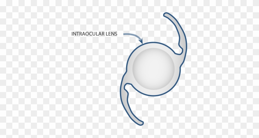 Cataract Lenses Iol Icon - Cataract #739729