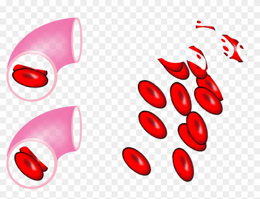 Red Blood Cells > - Red Blood Cells > #744217