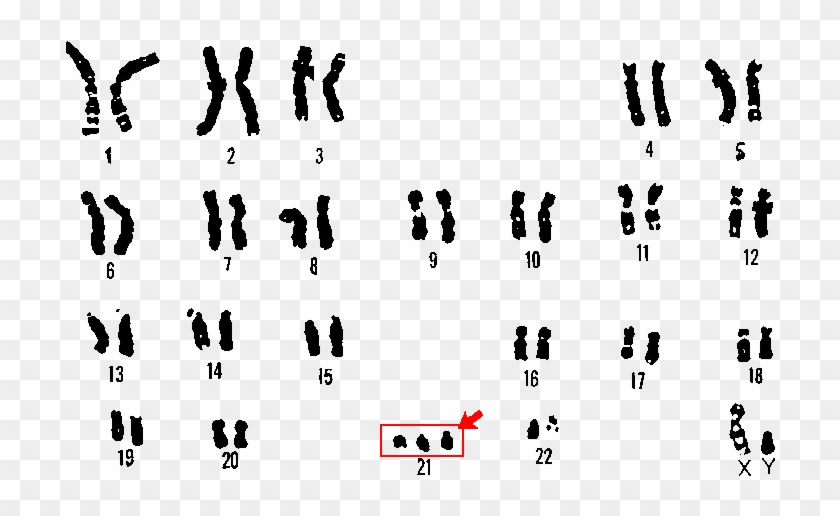 Inheritance Of Mitochondrial And Chloroplast Dna - Down Syndrome Scientific #748406