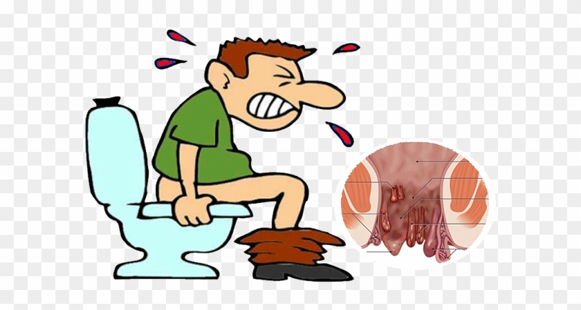 One Of The Best Ayurvedic Medicine For Piles Available - Chronic Constipation #764276