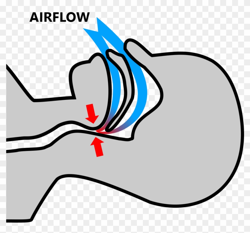 Without Snoremedic - Without Snoremedic #773015