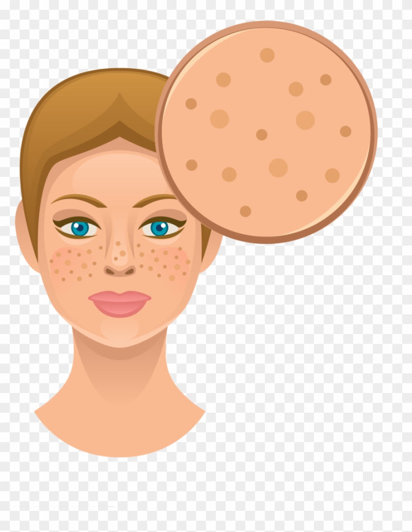 Dirty Facial Skin - Dark Circles Under Eyes Cartoon #785371