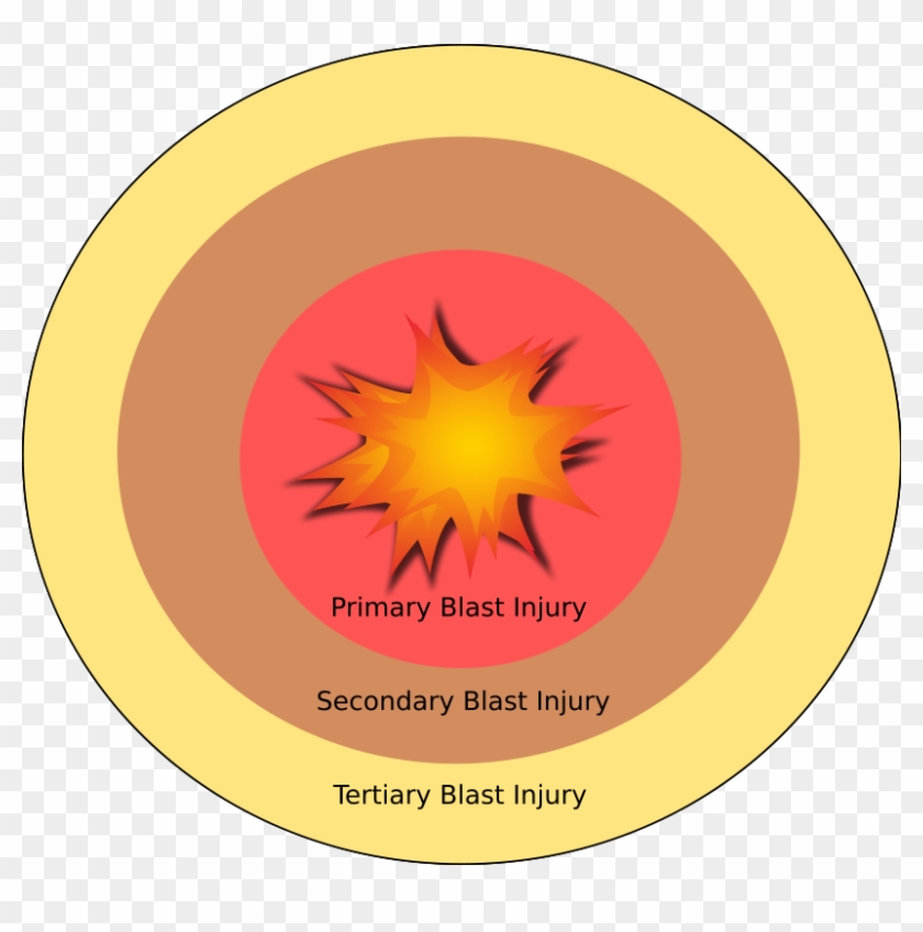 Explosion Blast Injury Explosive Material Blast Wave - Explosion Blast Injury Explosive Material Blast Wave #805683