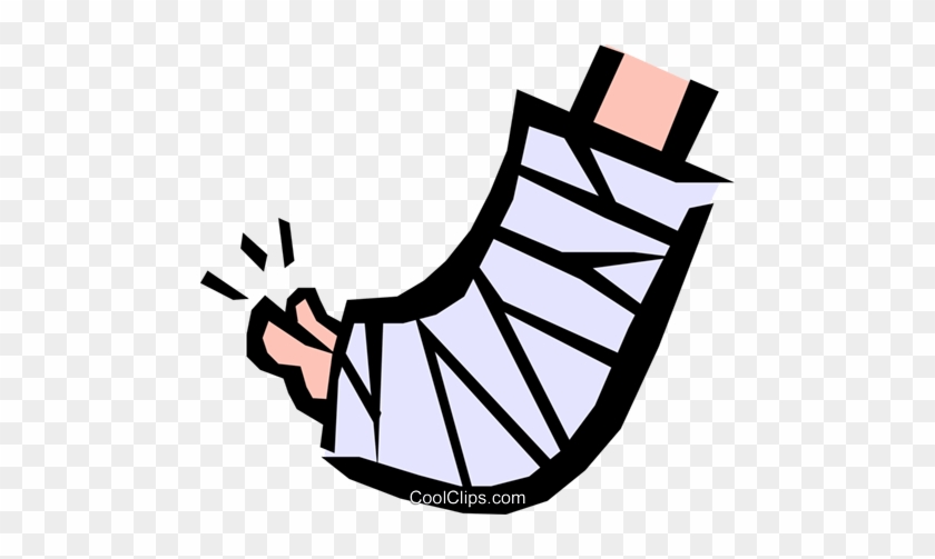 Cast On Foot Clip Art #853837