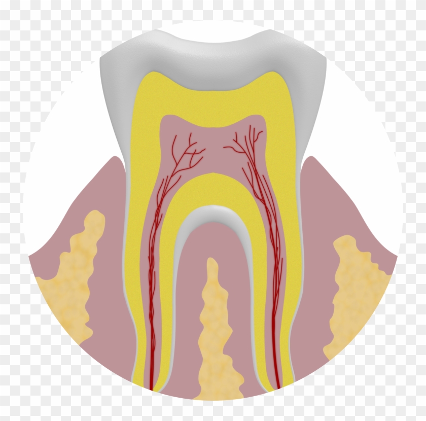 Object Stuck In Teeth - Illustration #854595