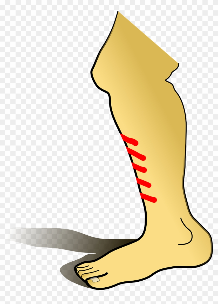 Importance Of Manganese - Leg Clip Art #163429