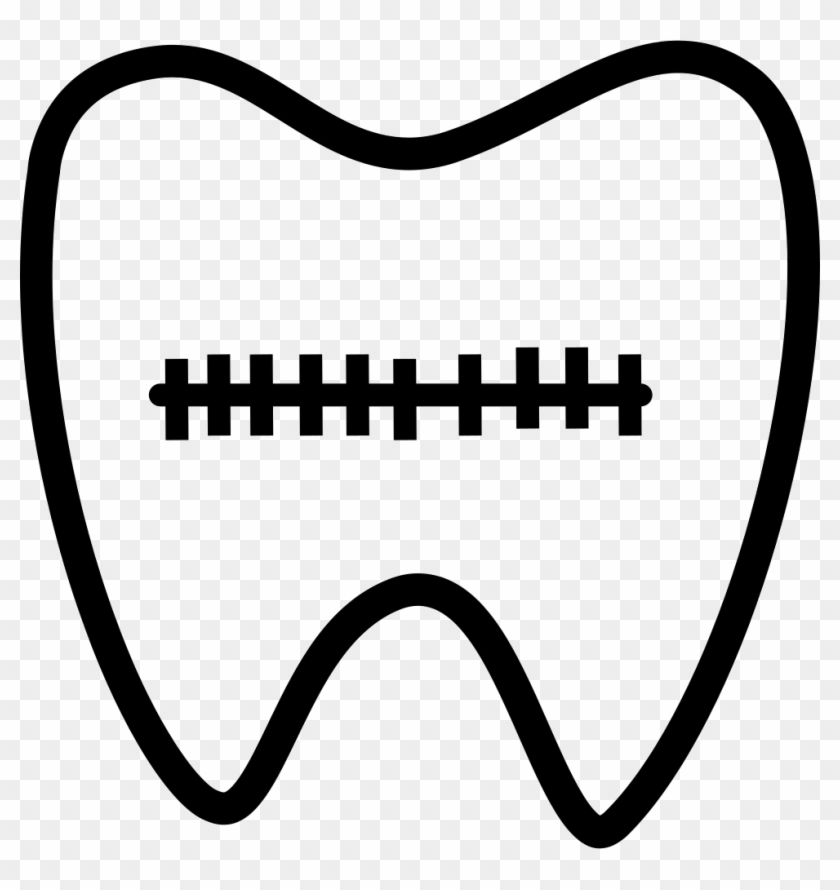 Tooth Correction Bracket Comments - Tooth #866433