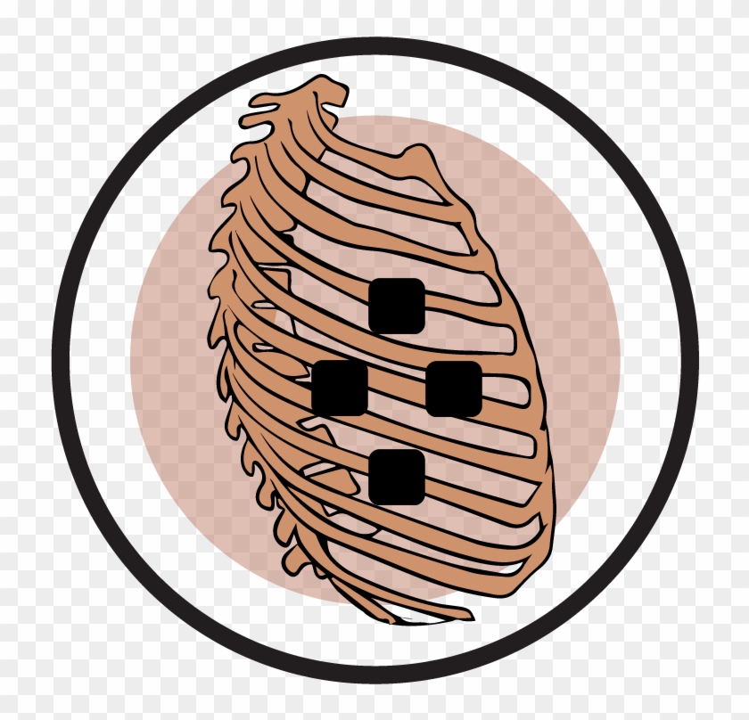 Rib Cage Pain Due To Degenerative Arthritis - Submarine Force Library And Museum #871772