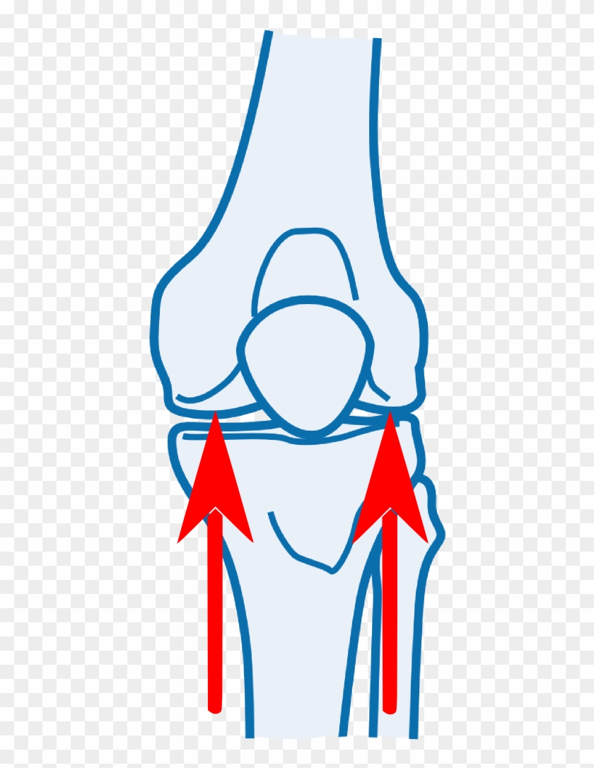 Knee Joint Orthopaedic Testing - Orthopedic Surgery #871851