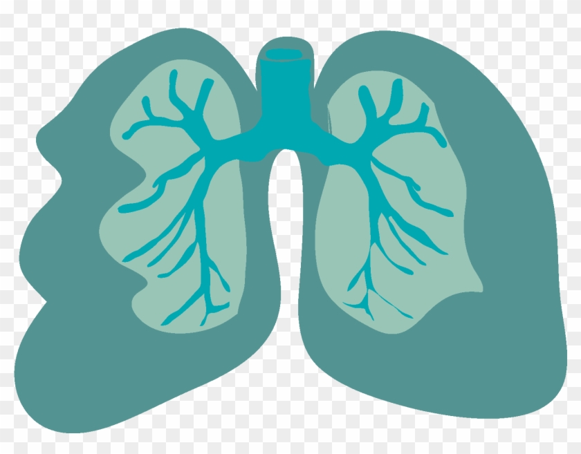La Enfermedad Pulmonar Obstructiva Crónica Es Una Dificultad - Pulmon Epoc Png #898427