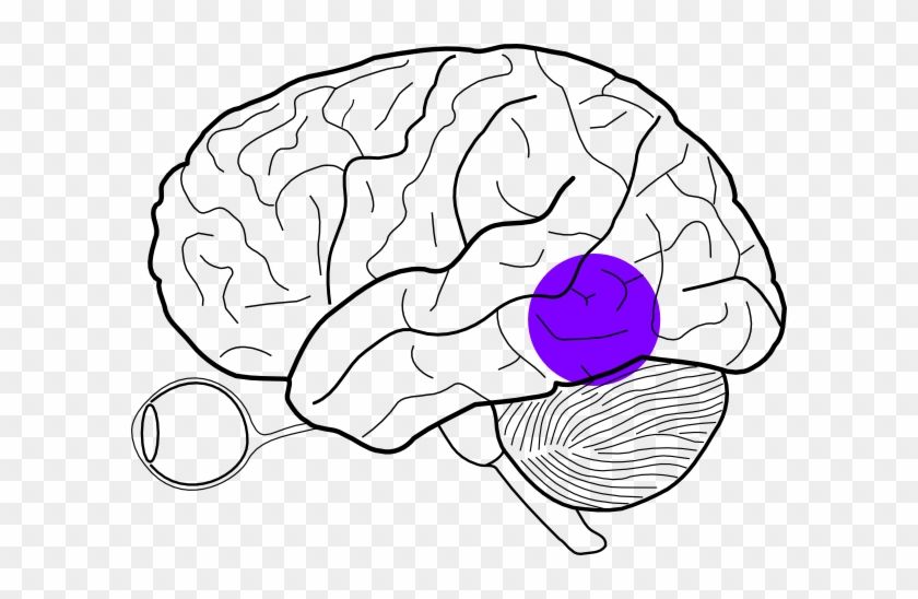 Brain 81. Нарисовать Lobe. Височные каналы рисунок.