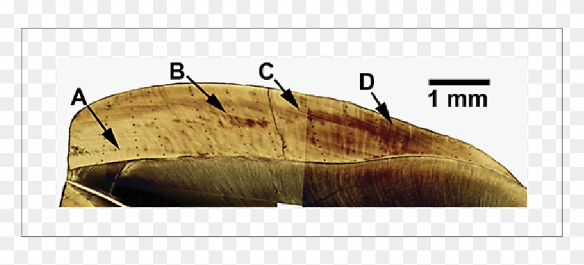 Low-power Photomontage Of M 1 In Male Baboon U9 - Canoe #927567