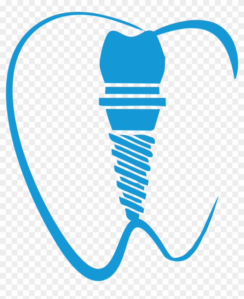 Dental Implant Dentistry Tooth Clip Art - Dental Implant Dentistry Tooth Clip Art #930210